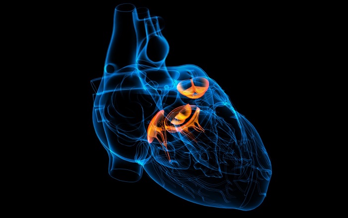 بیماری دریچه قلب؛ دلایل و عوامل خطرآفرین