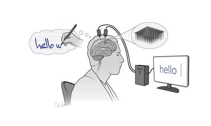 تبدیل افکار به متن با یک ایمپلنت مغزی جدید