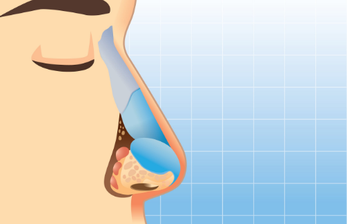 درمان تنفس از دهان با رینوپلاستی فانکشنال :رفع خشکی دهان هنگام خواب