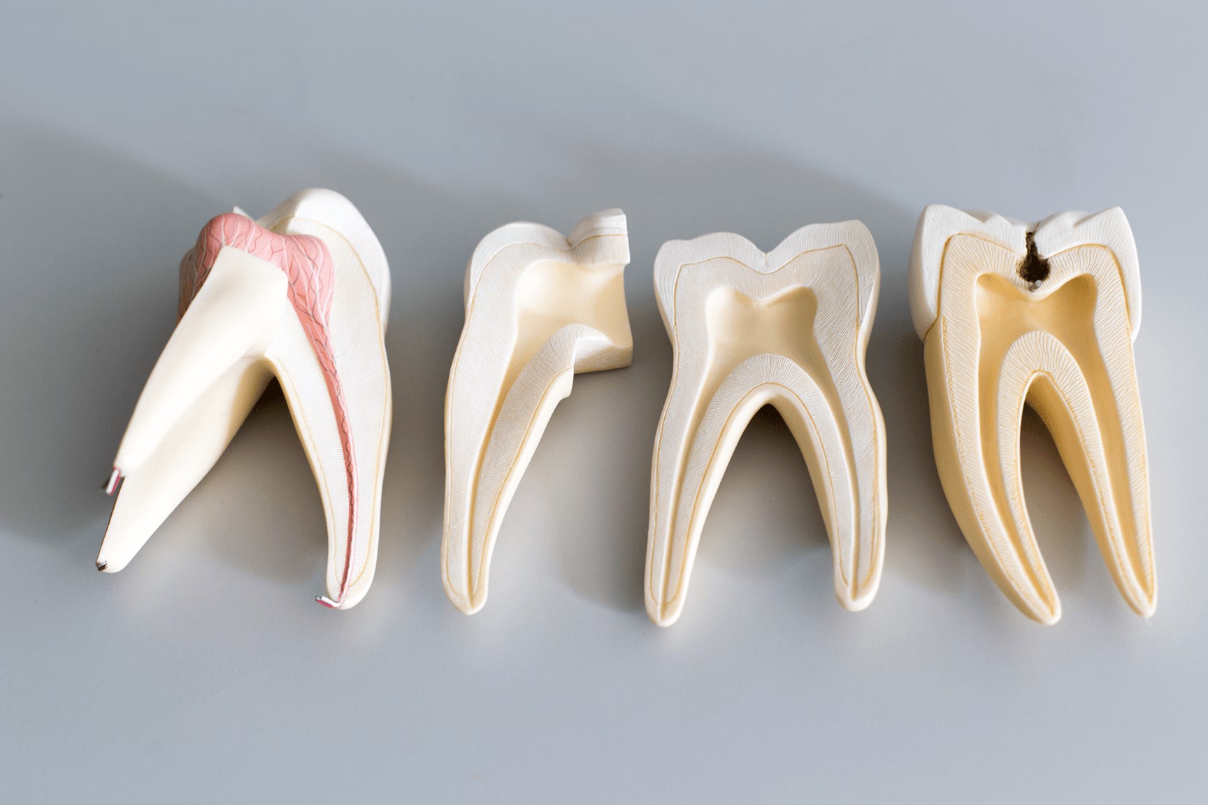 علائم درد ریشه دندان